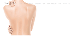 Desktop Screenshot of bodyimplants.com